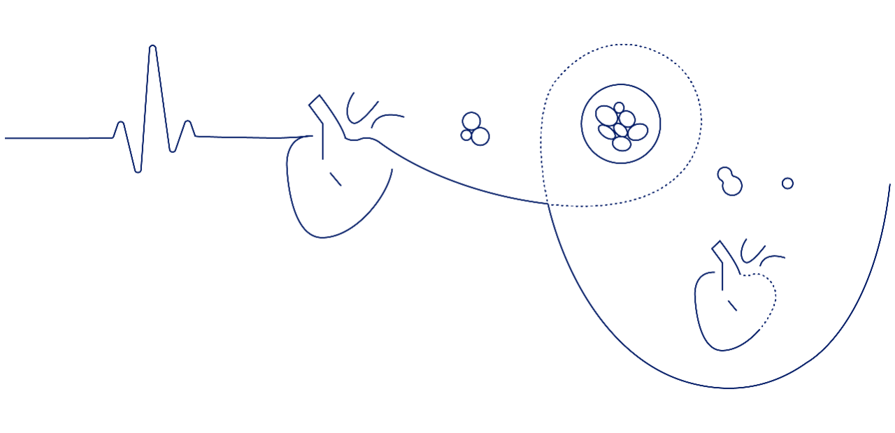 Chronic Heart Failure illustration